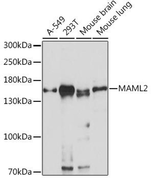 Cell Biology Antibodies 13 Anti-MAML2 Antibody CAB17225