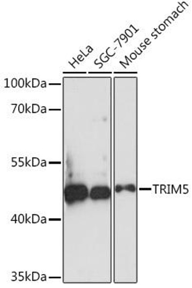 Immunology Antibodies 3 Anti-TRIM5 Antibody CAB17234