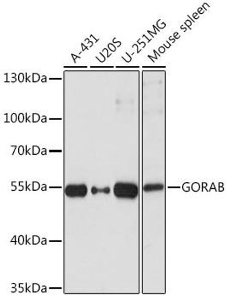 Cell Biology Antibodies 13 Anti-GORAB Antibody CAB17245