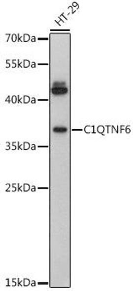 Cell Biology Antibodies 13 Anti-C1QTNF6 Antibody CAB17249