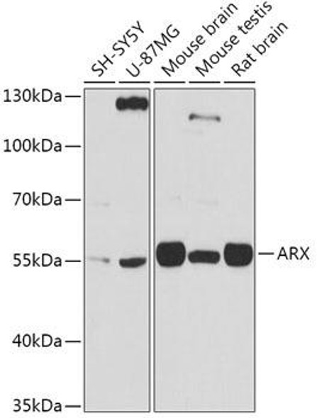 Cell Biology Antibodies 13 Anti-ARX Antibody CAB17267