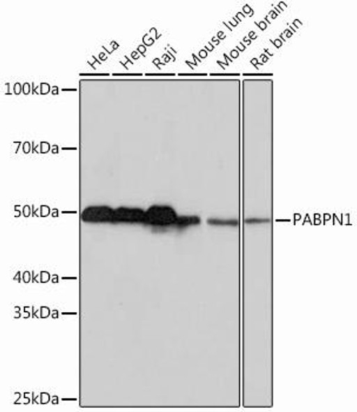 Epigenetics and Nuclear Signaling Antibodies 5 Anti-PABPN1 Antibody CAB1735