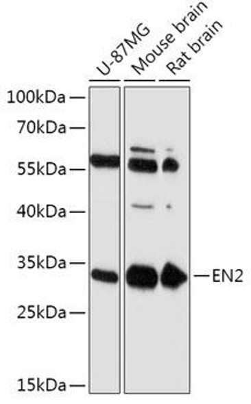 Cell Biology Antibodies 13 Anti-EN2 Antibody CAB17480