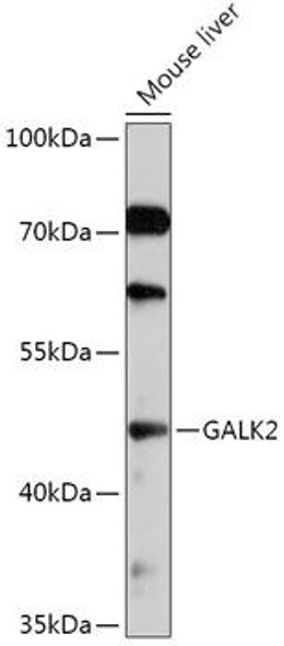 Cell Biology Antibodies 13 Anti-GALK2 Antibody CAB17486