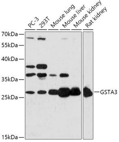 Cell Biology Antibodies 13 Anti-GSTA3 Antibody CAB17491