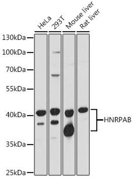 Cell Biology Antibodies 13 Anti-HNRPAB Antibody CAB17497