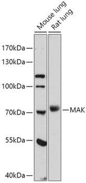 Cell Biology Antibodies 13 Anti-MAK Antibody CAB17508