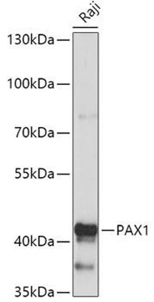 Cell Biology Antibodies 13 Anti-PAX1 Antibody CAB17513