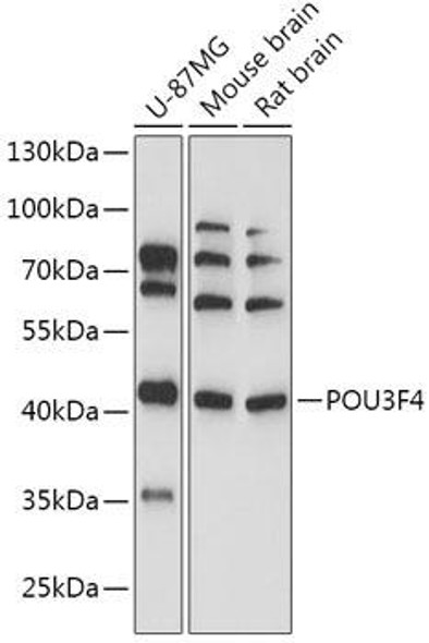 Cell Biology Antibodies 13 Anti-POU3F4 Antibody CAB17521