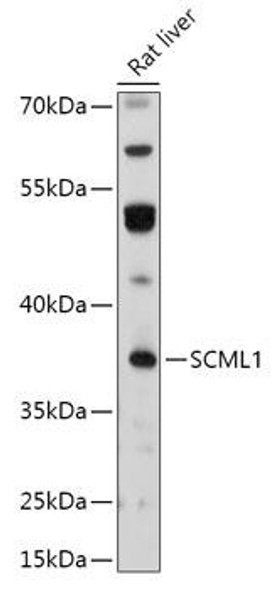 Cell Biology Antibodies 13 Anti-SCML1 Antibody CAB17529
