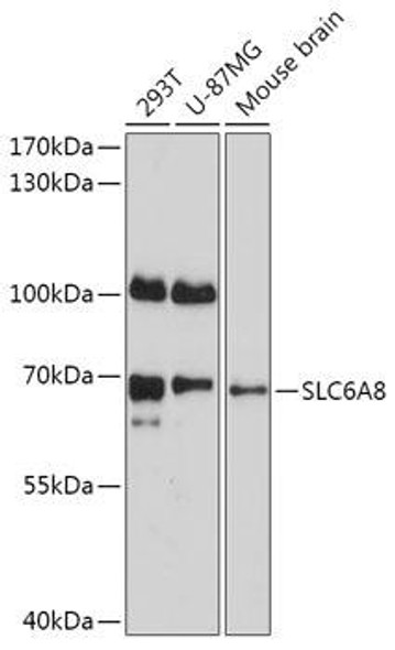 Cell Biology Antibodies 13 Anti-SLC6A8 Antibody CAB17531