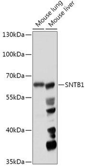 Cell Biology Antibodies 13 Anti-SNTB1 Antibody CAB17534