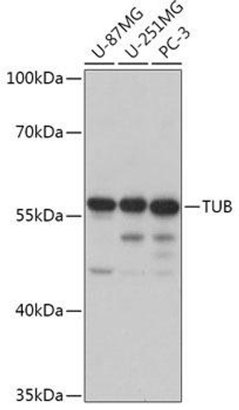 Cell Biology Antibodies 13 Anti-TUB Antibody CAB17545