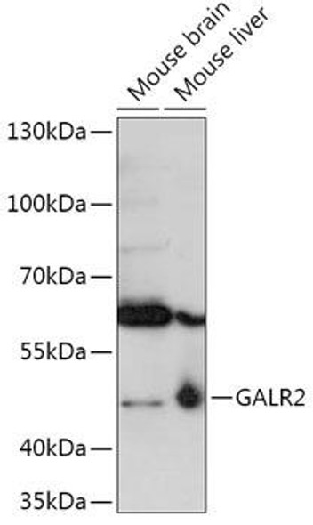 Cell Biology Antibodies 13 Anti-GALR2 Antibody CAB17577
