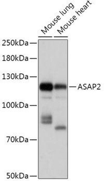 Cell Biology Antibodies 13 Anti-ASAP2 Antibody CAB17579