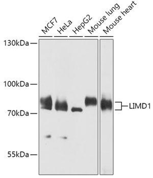 Cell Biology Antibodies 13 Anti-LIMD1 Antibody CAB17585