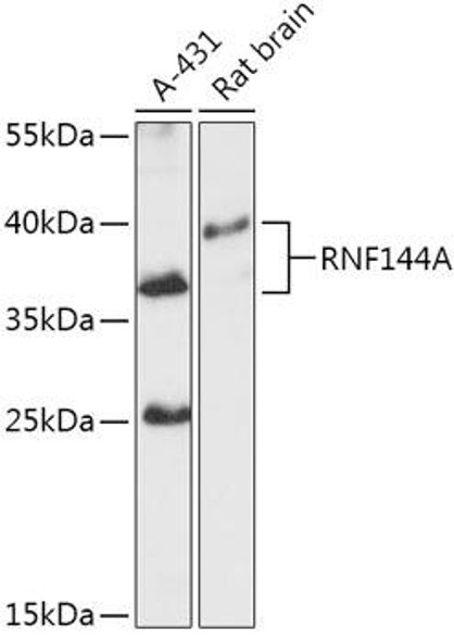 Cell Biology Antibodies 13 Anti-RNF144A Antibody CAB17597