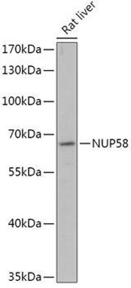 Cell Biology Antibodies 13 Anti-NUP58 Antibody CAB17598