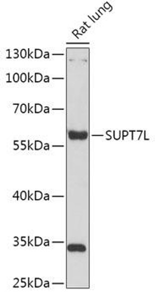 Cell Biology Antibodies 13 Anti-SUPT7L Antibody CAB17601