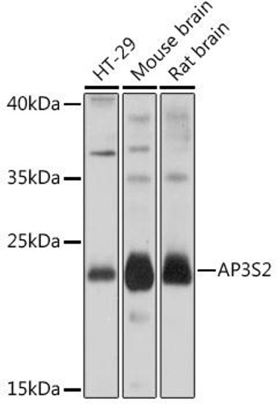 Cell Biology Antibodies 13 Anti-AP3S2 Antibody CAB17607