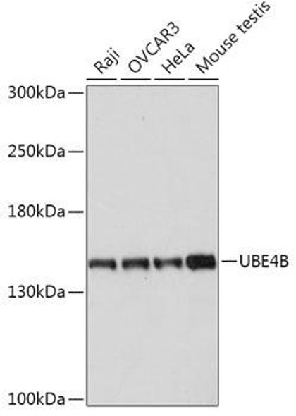 Cell Biology Antibodies 13 Anti-UBE4B Antibody CAB17609