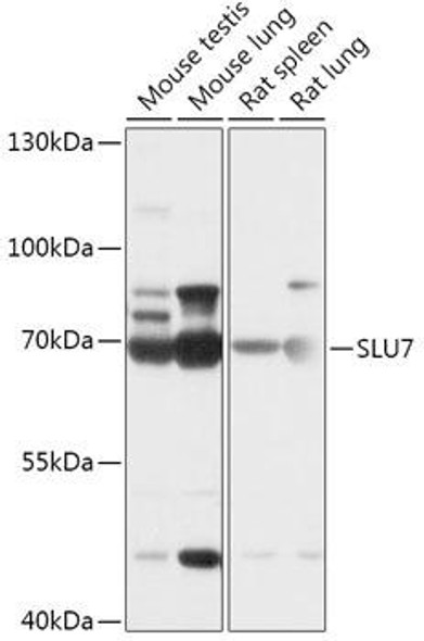 Cell Biology Antibodies 13 Anti-SLU7 Antibody CAB17614