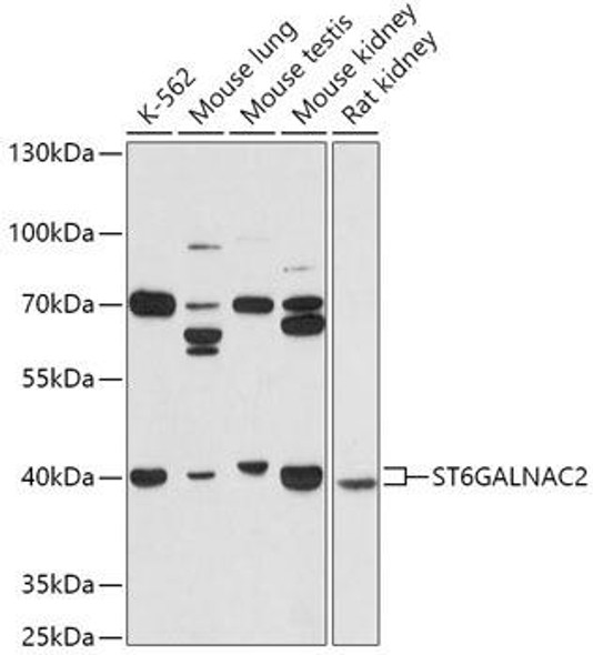 Cell Biology Antibodies 13 Anti-ST6GALNAC2 Antibody CAB17618
