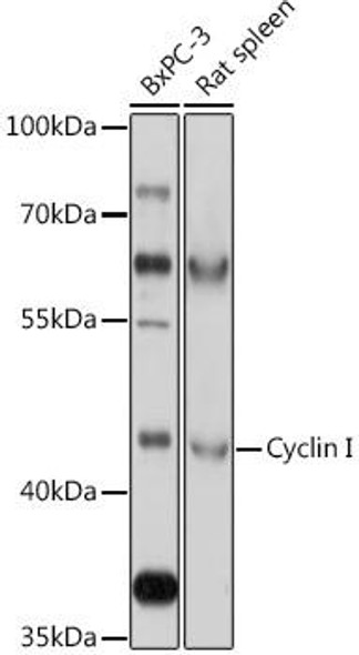 Cell Biology Antibodies 13 Anti-Cyclin I Antibody CAB17623