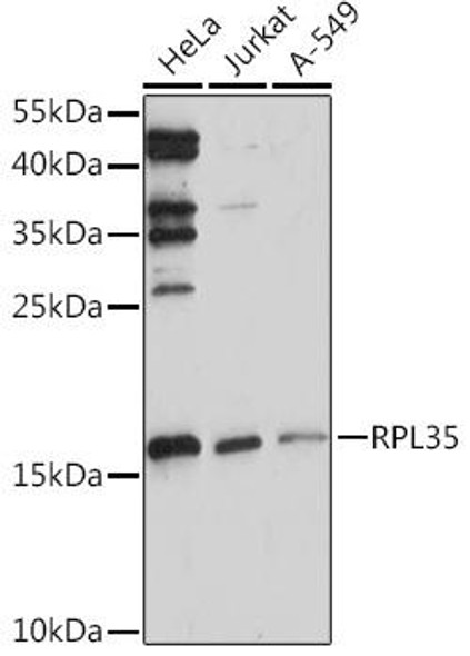 Cell Biology Antibodies 13 Anti-RPL35 Antibody CAB17632