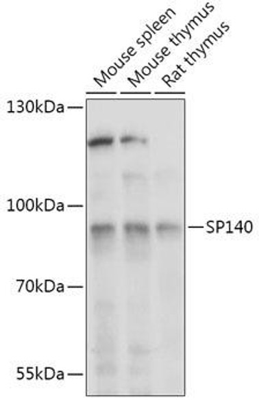 Cell Biology Antibodies 13 Anti-SP140 Antibody CAB17634