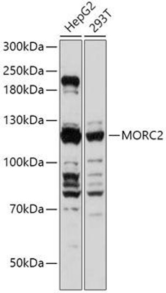 Cell Biology Antibodies 13 Anti-MORC2 Antibody CAB17641