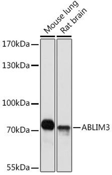 Cell Biology Antibodies 13 Anti-ABLIM3 Antibody CAB17643