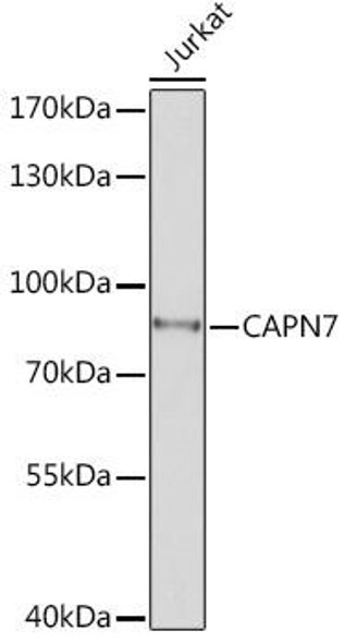 Cell Biology Antibodies 13 Anti-CAPN7 Antibody CAB17666