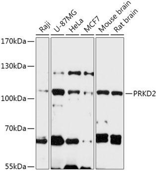 Cell Biology Antibodies 13 Anti-PRKD2 Antibody CAB17670