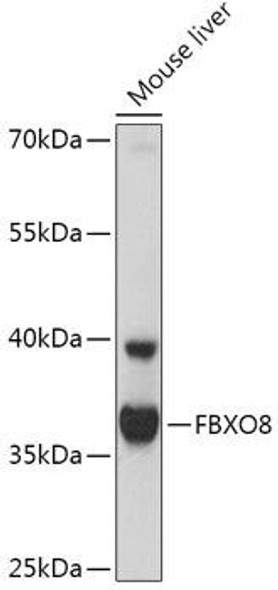 Cell Biology Antibodies 13 Anti-FBXO8 Antibody CAB17681