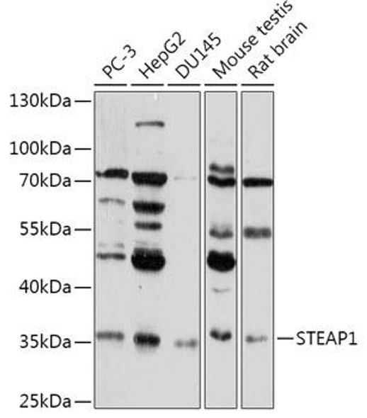 Cell Biology Antibodies 13 Anti-STEAP1 Antibody CAB17684