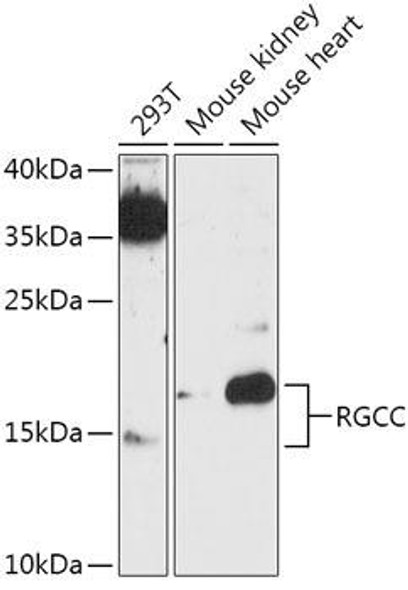 Cell Biology Antibodies 13 Anti-RGCC Antibody CAB17689