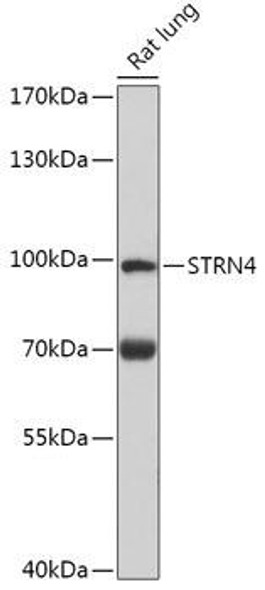 Cell Biology Antibodies 13 Anti-STRN4 Antibody CAB17694