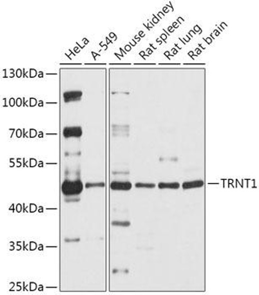 Cell Biology Antibodies 13 Anti-TRNT1 Antibody CAB17699