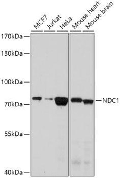 Cell Biology Antibodies 13 Anti-NDC1 Antibody CAB17727