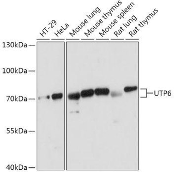 Cell Biology Antibodies 13 Anti-UTP6 Antibody CAB17730