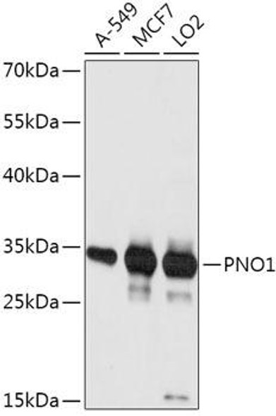 Cell Biology Antibodies 13 Anti-PNO1 Antibody CAB17736