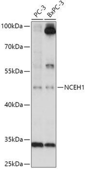 Cell Biology Antibodies 13 Anti-NCEH1 Antibody CAB17741