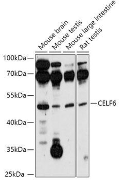 Cell Biology Antibodies 16 Anti-CELF6 Antibody CAB17748