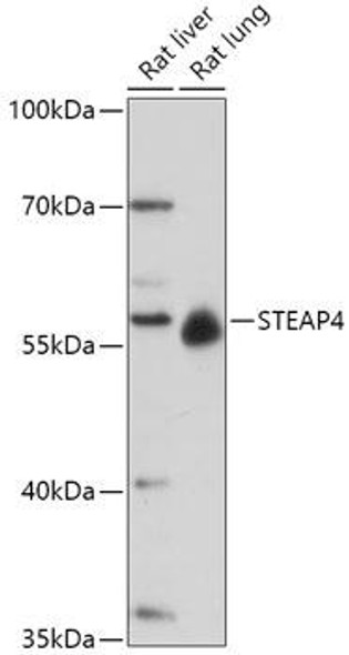 Cell Biology Antibodies 15 Anti-STEAP4 Antibody CAB17767