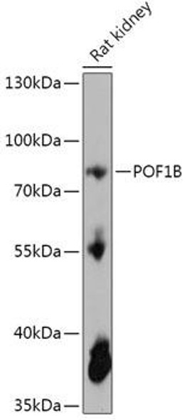 Cell Biology Antibodies 15 Anti-POF1B Antibody CAB17775