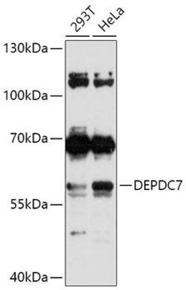Cell Biology Antibodies 15 Anti-DEPDC7 Antibody CAB17805