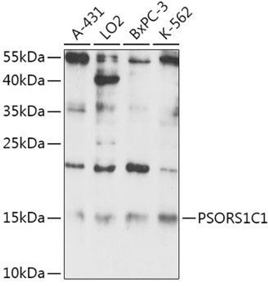 Cell Biology Antibodies 15 Anti-PSORS1C1 Antibody CAB17841