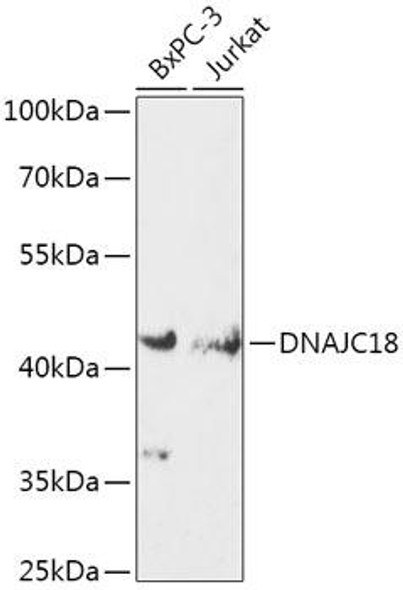 Cell Biology Antibodies 15 Anti-DNAJC18 Antibody CAB17843