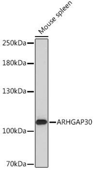 Cell Biology Antibodies 15 Anti-ARHGAP30 Antibody CAB17847